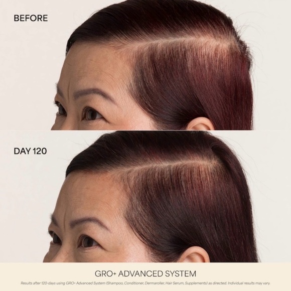 🎸Vegamour🎸🔥NWT🔥GRO+ Advanced Hair Serum for Severe Signs of Thinning-1 FI oz. - Picture 11 of 16